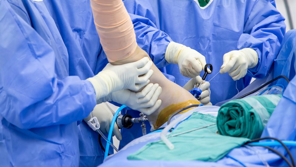 Shoulder Arthroscopy Orthopaedic Surgeon Lucknow